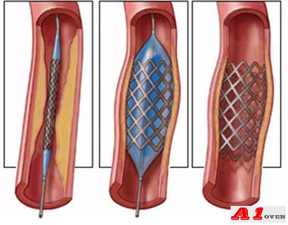 醫(yī)療器械潔凈烤箱案例展示